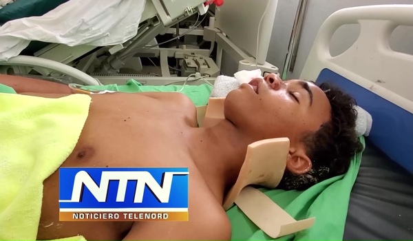 Hospitalizan joven fue atropellado por avanzada del presidente en Samaná