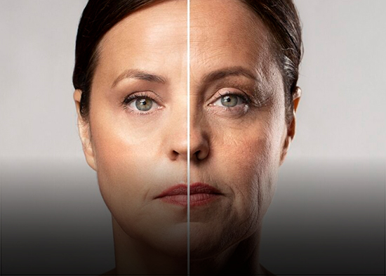 Consejos para prevenir el temido “ozempic face” y “mounjaro face”