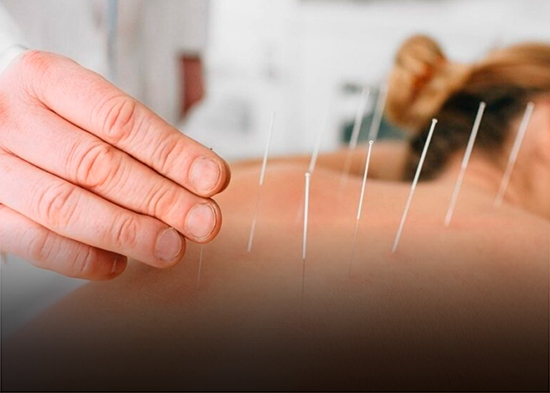 La acupuntura gana terreno frente a ‘niebla mental’ tras el cáncer