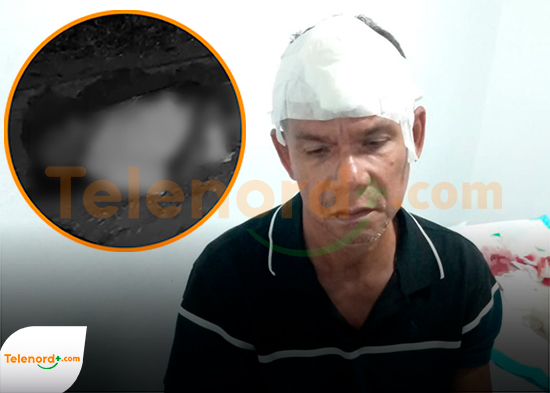 Hombre muere tras presunto enfrentamiento con su hermano en SFM